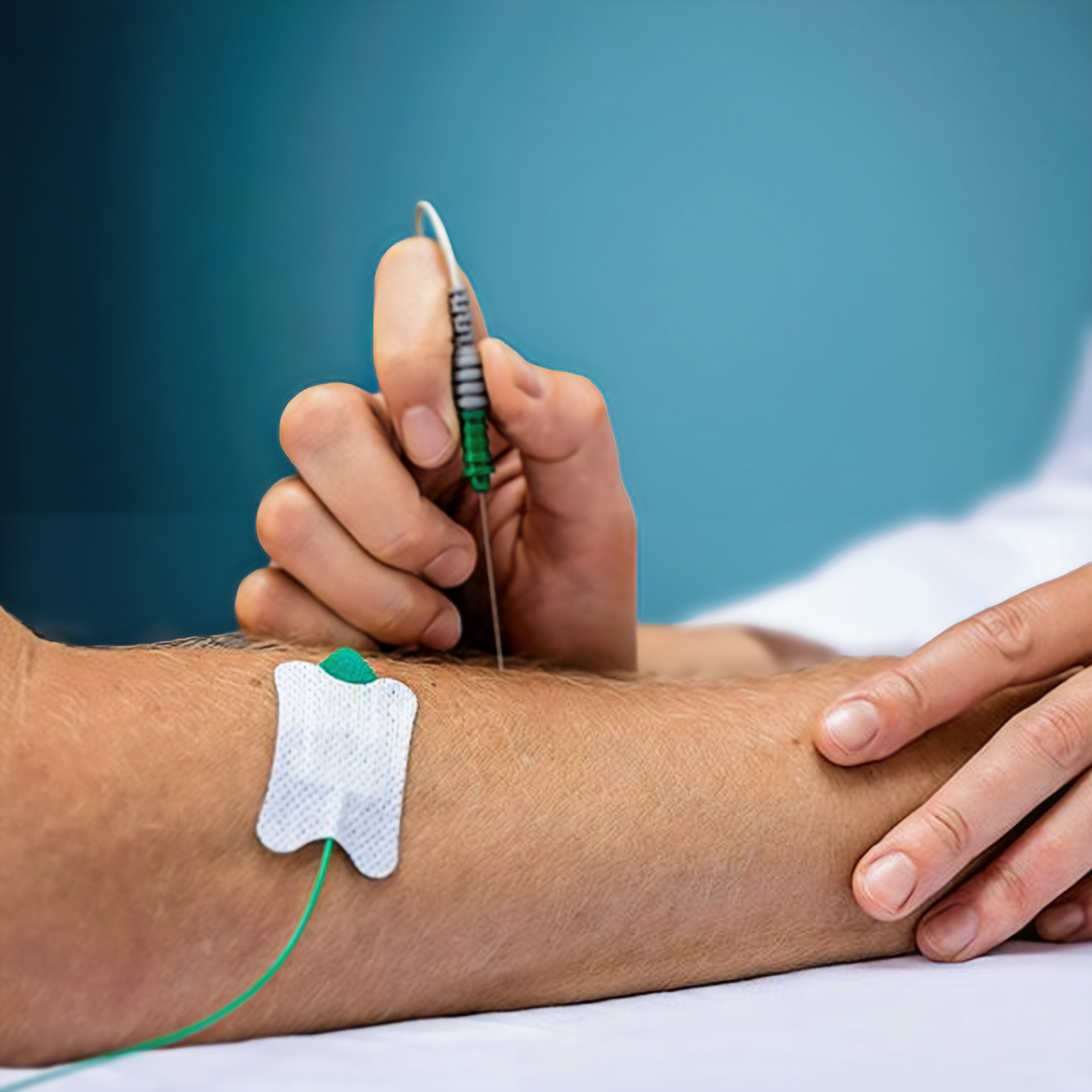 Electromyography